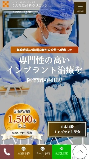 うえたに歯科クリニック様（インプラント専門サイト）