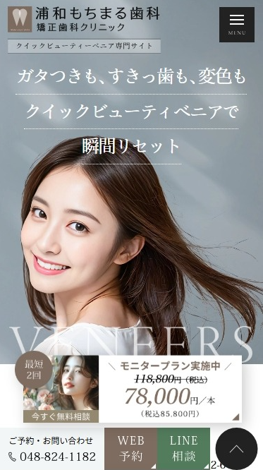 浦和もちまる歯科矯正歯科クリニック様（クイックビューティーべニア専門サイト）